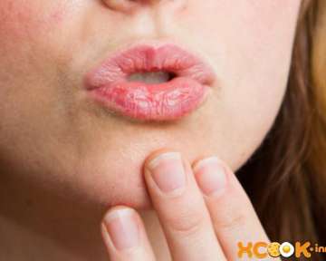 Причины, почему сильно сохнут губы, признаки заболеваний, а также способы лечения