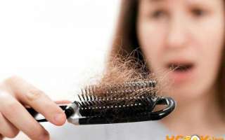 Диффузное выпадение волос у женщин – причины, а также средства и способы лечения народными средствами