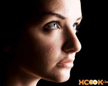 Просянка на лице – причины и лечение
