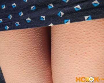 Причины появления гусиной кожи на ногах; как избавиться в домашних условиях? – текстовая и видео инструкция