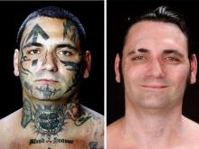 удаление татуировок - до и после
